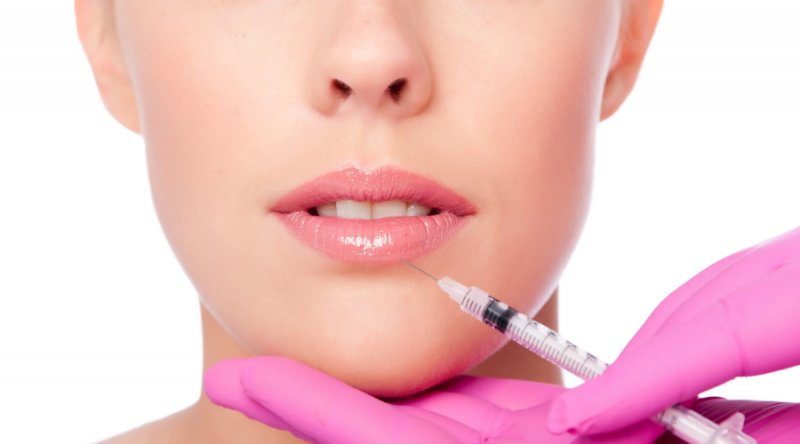 Lip Injections – What to Expect